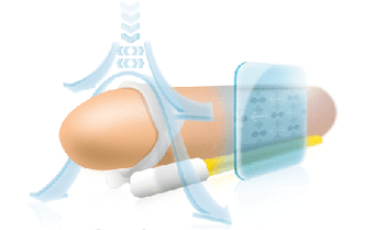 The principle of operation of the expander for lengthening the penis