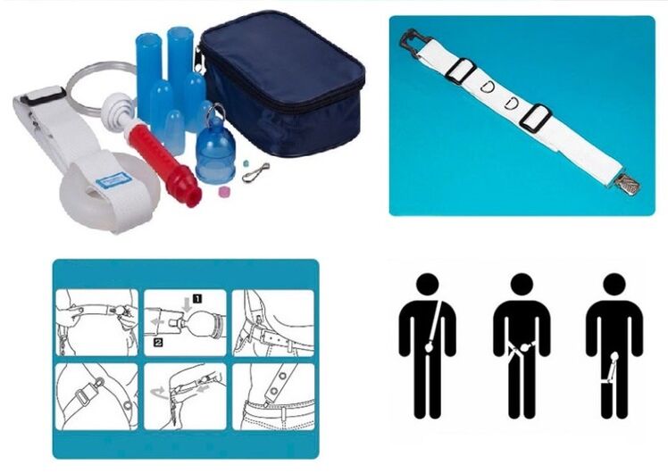 The stretcher can lengthen and widen the penis